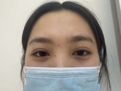 -长沙雅美医疗美容医院