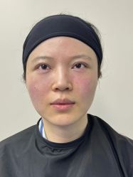 -广州健丽·去眼袋医疗美容机构