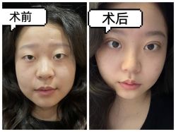 -素美医疗美容·西南眼鼻整形·修复基地