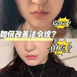 -Yestar宁波艺星整形医院