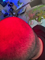 -碧莲盛·不剃发植发