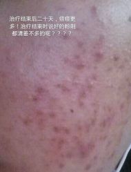 -痘院士祛痘美容皮肤管理