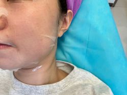 -北京米扬丽格医疗美容·联合丽格鼻整形中心