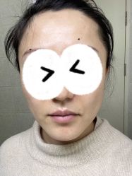-北京米扬丽格医疗美容·联合丽格鼻整形中心