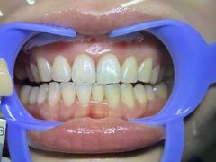 -极光口腔·矫正种植修复(锦江院区)