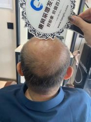-唐风采假发补发定制