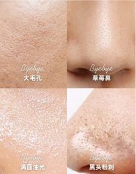 点击看大图 -SKIN79皮肤管理中心