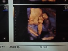 -济南艾玛体检中心