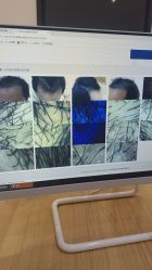 -雍禾植发全国连锁