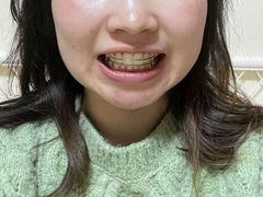 -极光口腔·矫正种植修复(锦江店)