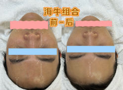 -海菲秀·飞顿牛奶光·LDM官方授权中心美轮美浣瓷感美肌
