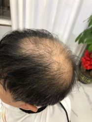 -发饰美男士增发补发假发定制店