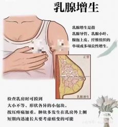-香薇妮丝女子减肥院