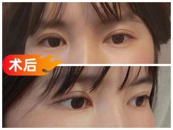 -素美医疗美容·西南眼鼻整形·修复基地