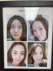 -紫洁俪方（北京）医疗美容