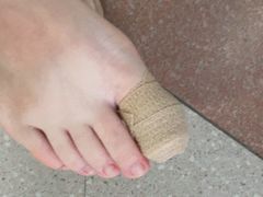 -世龙世家灰指甲鸡眼脚气甲沟炎跖疣护理(通州店)