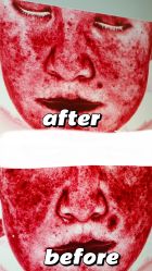 -紫御国际抗衰ZOE ANTI AGING