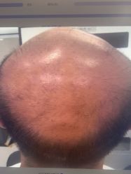 -雍禾植发全国连锁