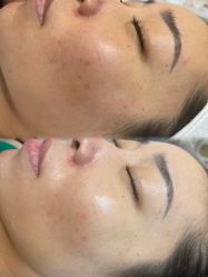 -SKIN79皮肤管理中心