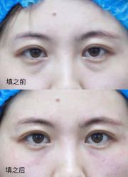 体验前-西美医疗美容门诊部