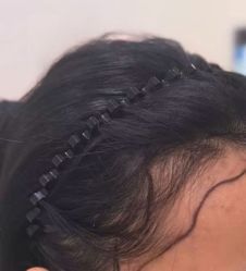 -雍禾植发全国连锁