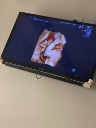 -杭州贝瑞斯美华妇儿医院·早孕·产检·儿科