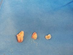 -深圳市人民医院(留医部)