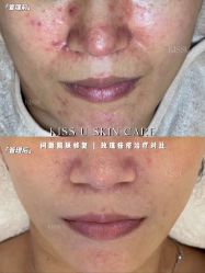 -KISS U 国际美学