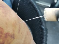 -悦和堂中医门诊部·疼痛调理·针灸推拿·艾灸拔罐