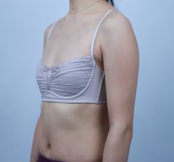 体验前-美莱医学美容医院