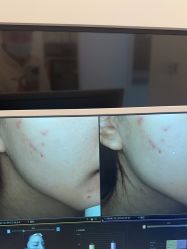 点击看大图 -苑苑vbeauty科技美容SPA