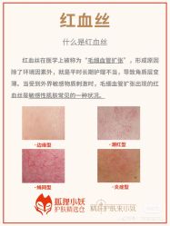 点击看大图 -玛莲朵·海菲秀冰珀科