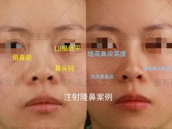 -北京米扬丽格医疗美容·联合丽格鼻整形中心