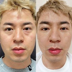 -长沙雅美医疗美容医院
