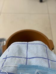 -派恩宜灰指甲鸡眼嵌甲手足癣