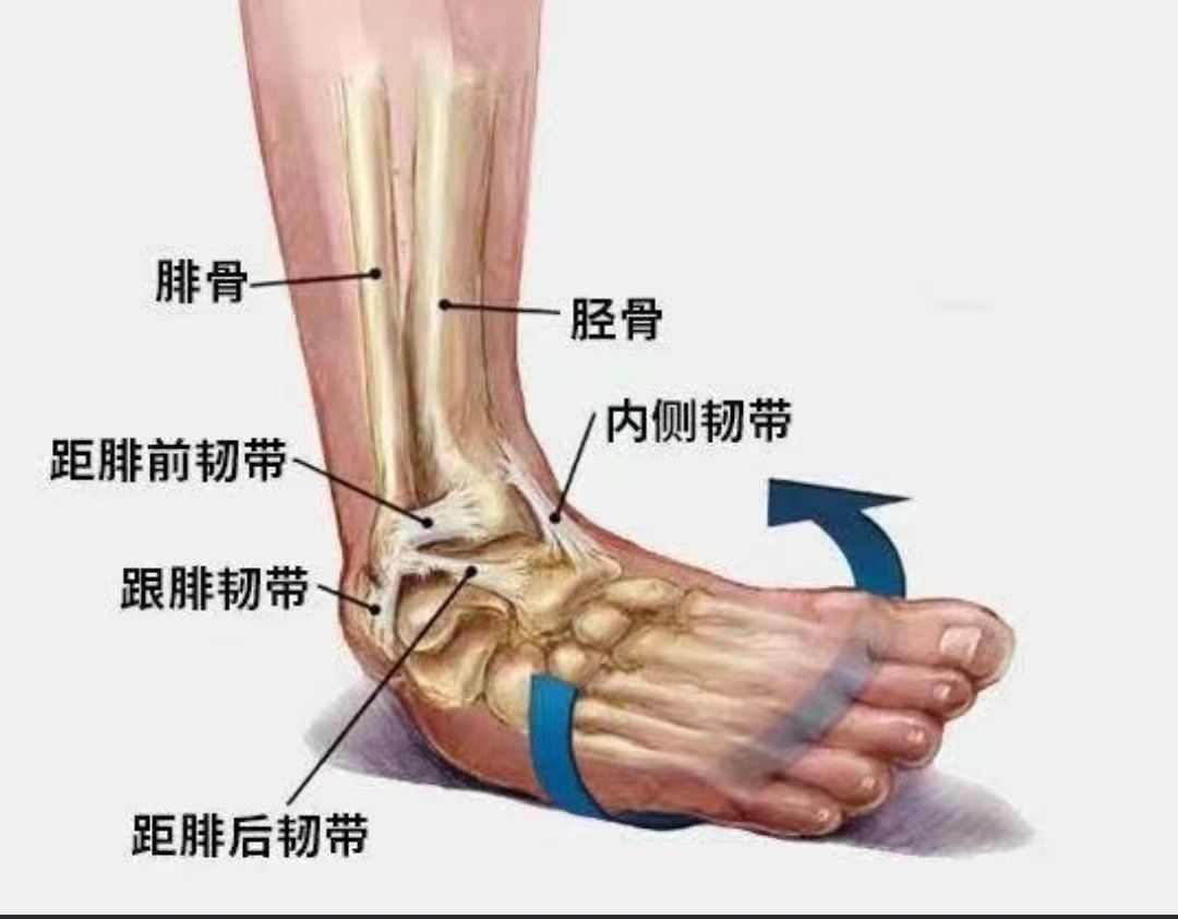 踝关节扭伤那些事儿