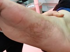 -新甲连锁灰指甲·甲沟炎·鸡眼(黑龙江路店)