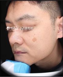 -韩国淼美颜皮肤管理官方直营店