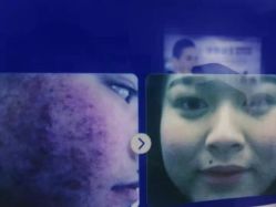 点击看大图 -成都军建医院·疤痕诊疗中心