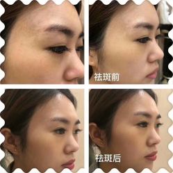 -兰派国际美容养生SPA