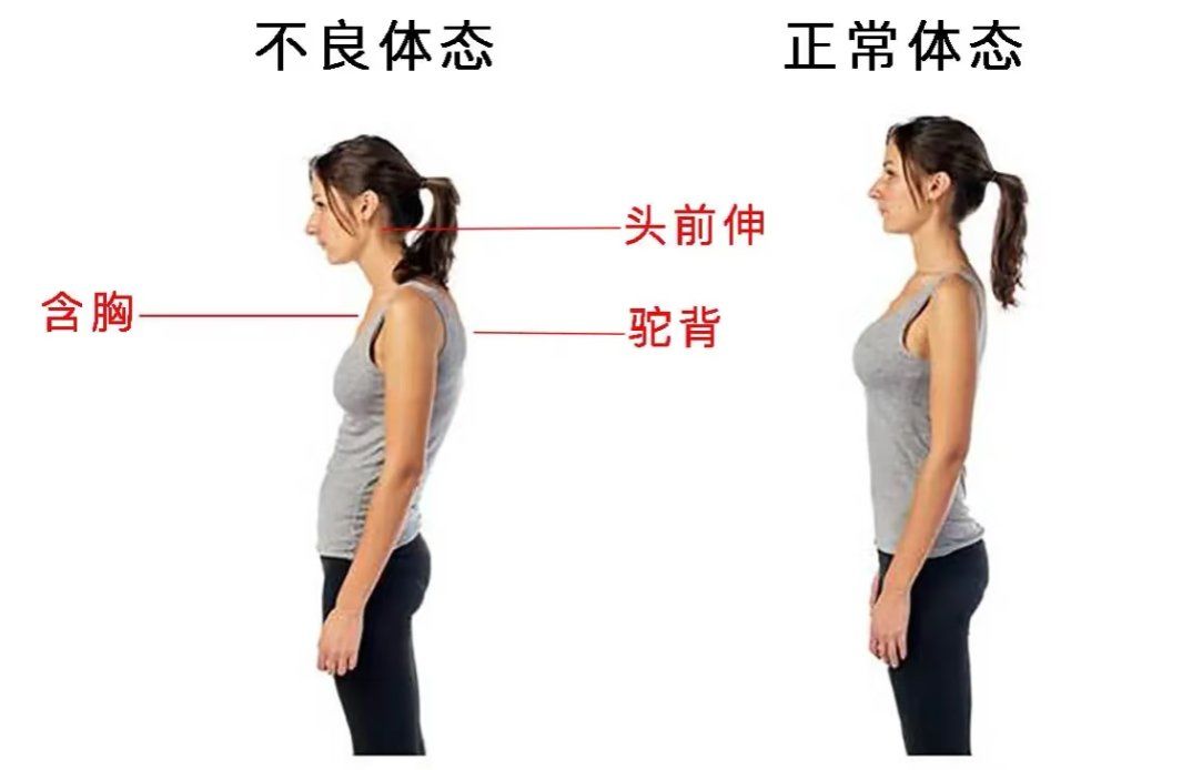 长期伏案工作,低头看手机等不良姿势,使身体长时间处于弯腰驼背状态