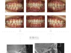 -齐玉齿科JADENTAL