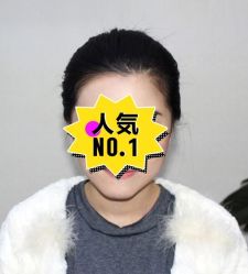 -大麦微针植发丨全国连锁