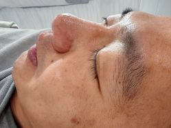 -SKIN79皮肤管理中心