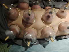 -艾通康缘艾灸.疼痛.睡眠养生馆(凤凰城店)
