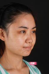 -北京米扬丽格医疗美容·联合丽格鼻整形中心