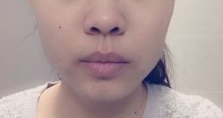 点击看大图 -西安现代妇产医院医疗美容