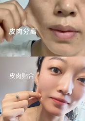 -美愈美肤MEIYU SKIN