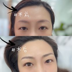 -Verywang半永久纹眉•仪器野生眉
