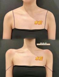 -Yestar艺星医疗美容医院